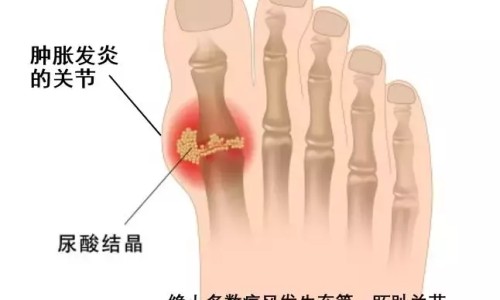 金乌骨痛胶囊补肾吗-【金乌骨痛胶囊治什么病】金乌骨痛胶囊属于补药吗 - 金乌骨痛胶囊主治什么网